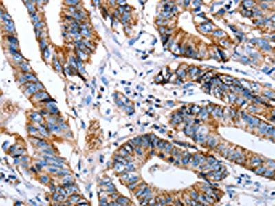 CLDN7 Antibody