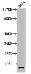 SUMO2 Antibody