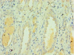 CLEC3B Antibody