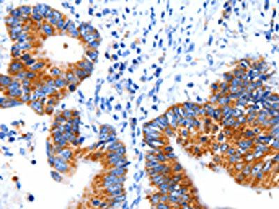 CLEC7A Antibody