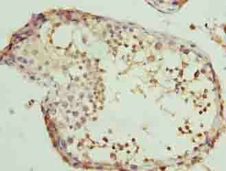 CLGN Antibody