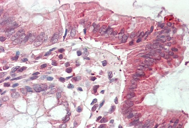 CLIC1/NCC27 Antibody