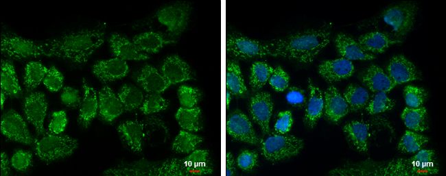 CLPP Rabbit Polyclonal Antibody