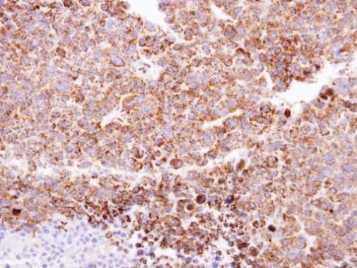 CLPP Rabbit Polyclonal Antibody