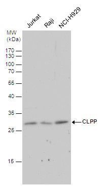 CLPP Rabbit Polyclonal Antibody