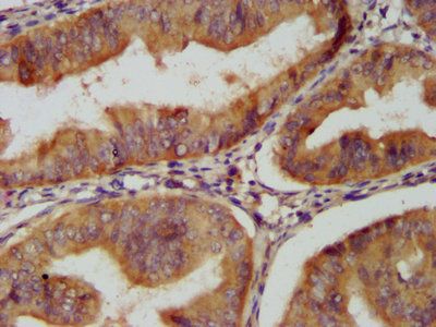 CLU Antibody