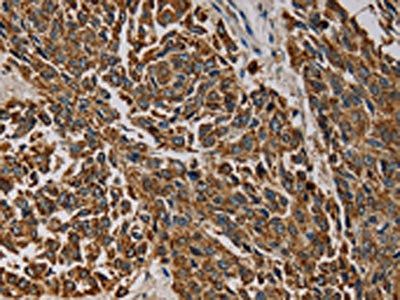 CMC4 Antibody