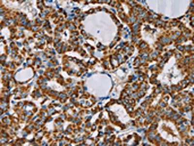 CMC4 Antibody