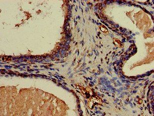 CNN3 Antibody