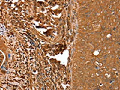 CNN3 Antibody