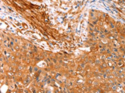 CNN3 Antibody