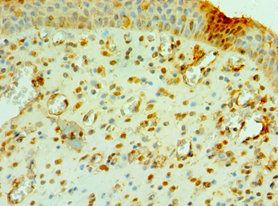 CNOT8 Antibody