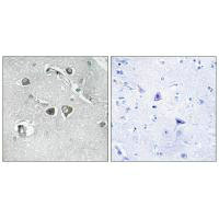 COL11A2 Antibody