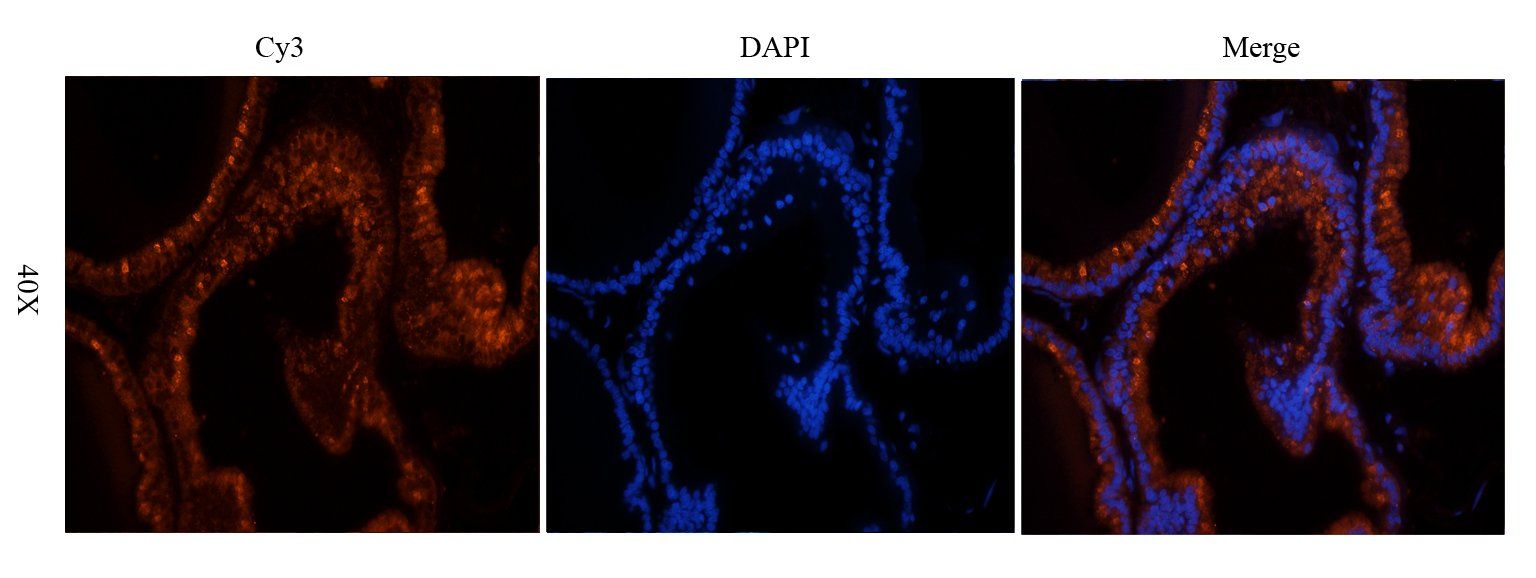 COL17A1 Rabbit Polyclonal Antibody