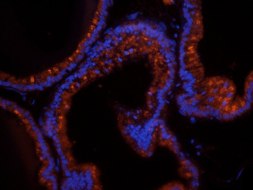 COL17A1 Rabbit Polyclonal Antibody