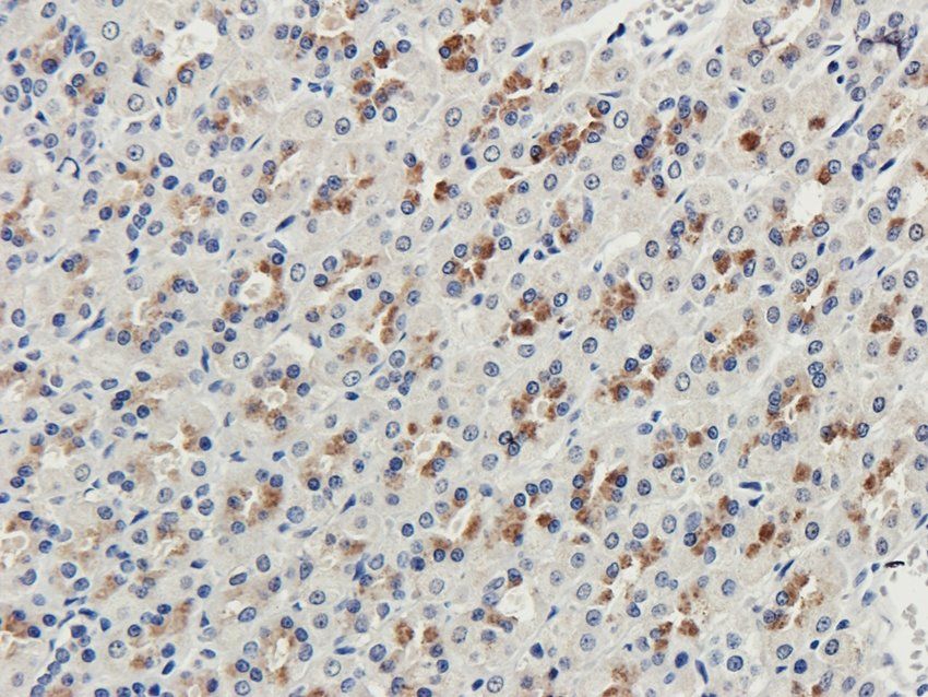 COL17A1 Rabbit Polyclonal Antibody