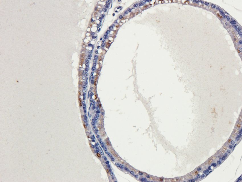 COL17A1 Rabbit Polyclonal Antibody