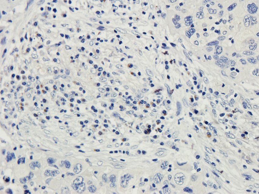 COL17A1 Rabbit Polyclonal Antibody