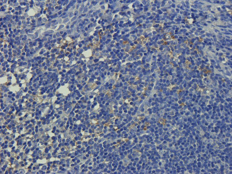 Collagen IV Rabbit Polyclonal Antibody