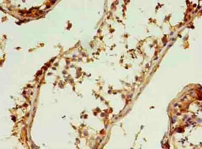 COL6A6 Antibody