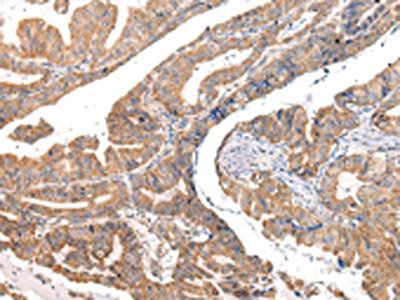 COL8A2 Antibody