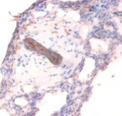 COL4A1 Antibody