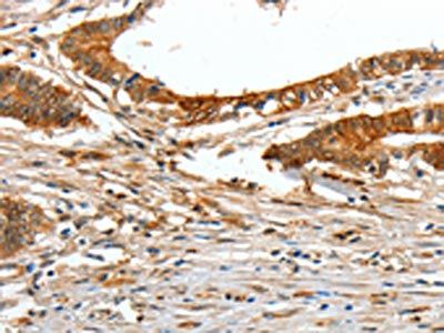 COL1A2 Antibody