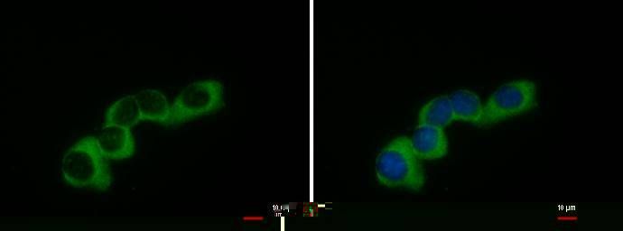 COL1A2 Rabbit Polyclonal Antibody