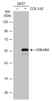 COL1A2 Rabbit Polyclonal Antibody