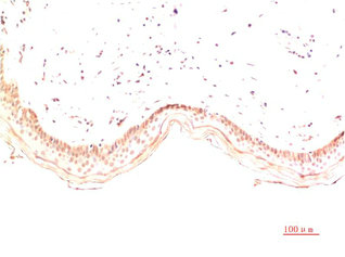 COL1A1 Antibody