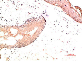 COL1A1 Antibody