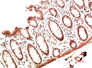 COL1A1 Antibody