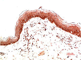 COL1A1 Antibody