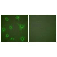 COL2A1 Antibody