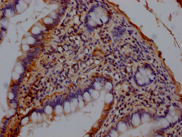 COL2A1 Antibody