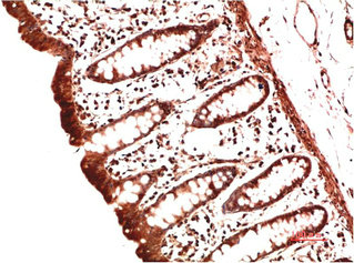 COL2A1 Antibody