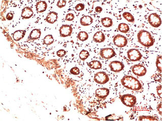 COL2A1 Antibody