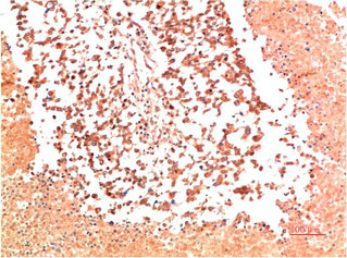 COL2A1 Antibody