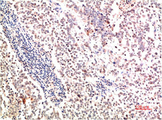 COL2A1 Antibody