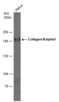 Collagen III Rabbit Polyclonal Antibody
