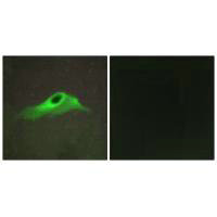 COL4A5 Antibody