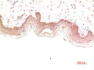 COL4A1 Antibody