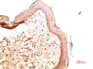 COL4A1 Antibody