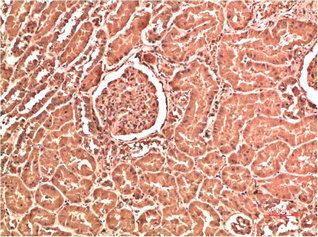 COL4A1 Antibody