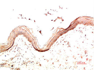 COL4A1 Antibody