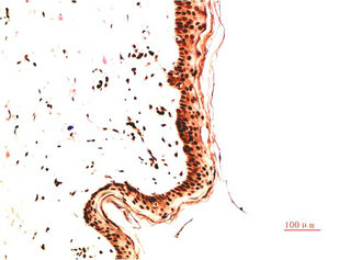 COL4A1 Antibody