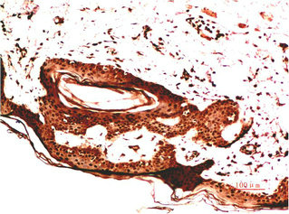 COL4A1 Antibody