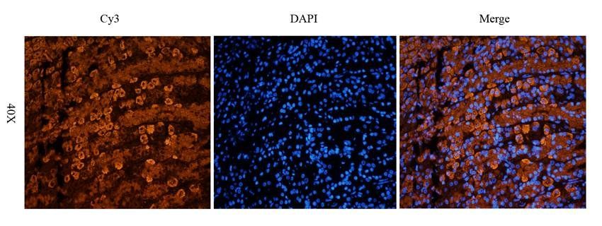 Collagen 4 alpha 1 Rabbit Polyclonal Antibody