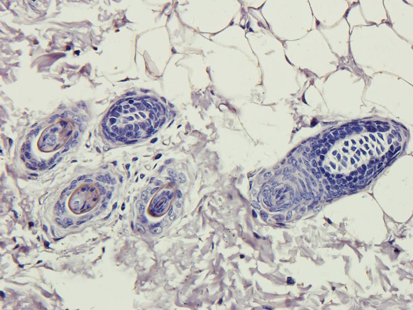 Collagen 4 alpha 1 Rabbit Polyclonal Antibody