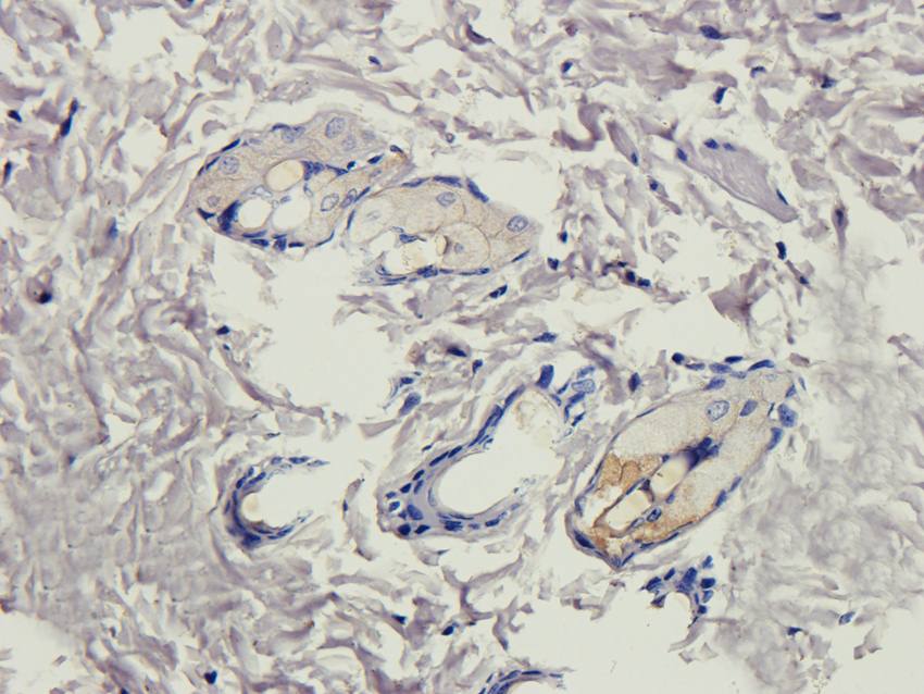 Collagen 4 alpha 1 Rabbit Polyclonal Antibody